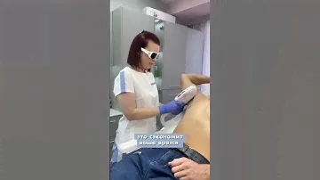 Лазерная эпиляция для мужчин😎 #лазернаяэпиляциябишкек #лазернаяэпиляция #гладкоебудущеереально